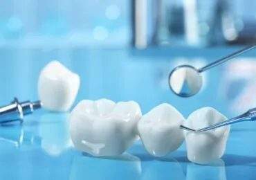 Ricostruzioni Dentali