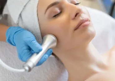 Terapia di Microneedling presso Zucchini Odontoiatra
