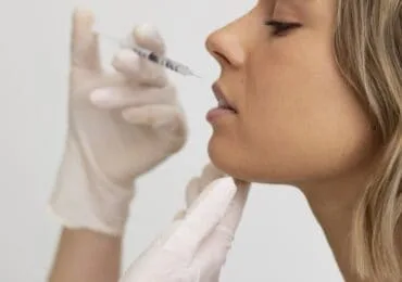 Terapia con Filler Labbra presso Zucchini odontoiatra